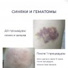 фото объявления